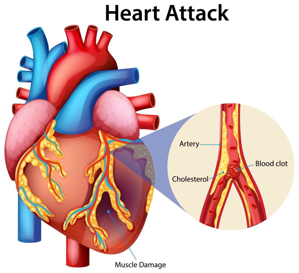 How to Lower Cholesterol: A Comprehensive Guide to a Healthier Heart 3 IMG 20251010 WA0002