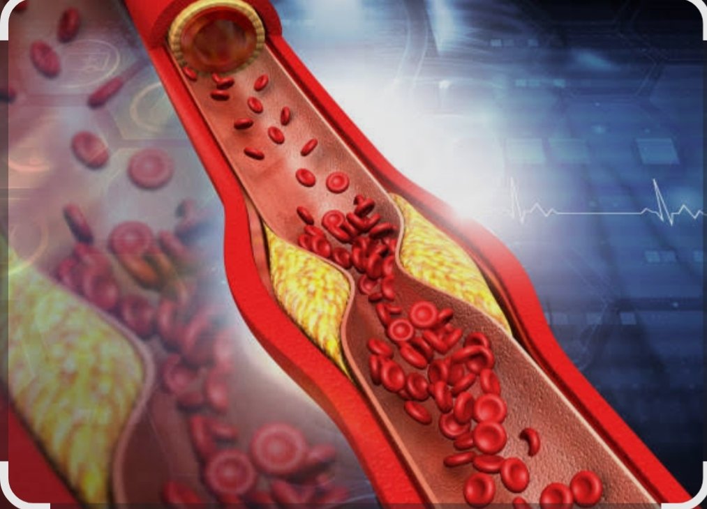 How to Lower Cholesterol: A Comprehensive Guide to a Healthier Heart 5 IMG 20251013 211903