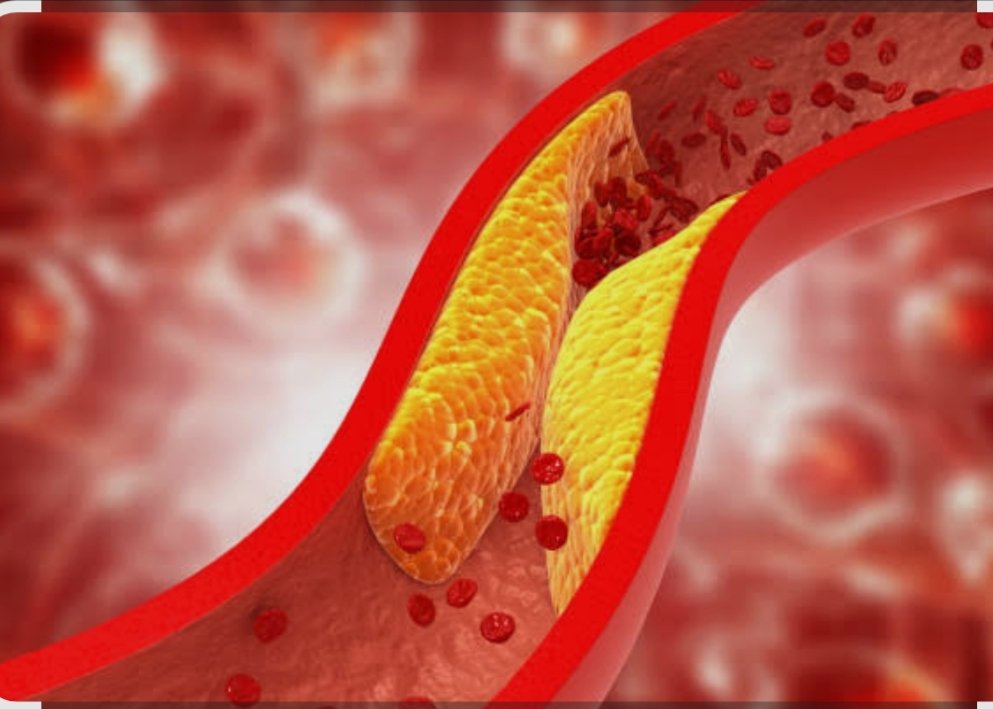 How to Lower Cholesterol: A Comprehensive Guide to a Healthier Heart 4 IMG 20251013 211938