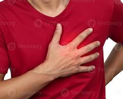 What Causes Chest Pain and How to Cure It: A Comprehensive Guide 2 image 18