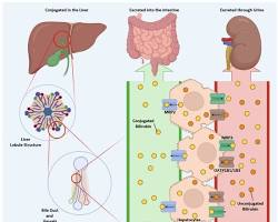 8. Treatment for High Bilirubin in the Blood: Causes, Medical Care, and How to Control It 4 image 5