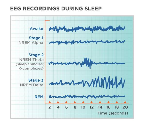 How Lack of Sleep Affects Your Body and Brain 3 image 12