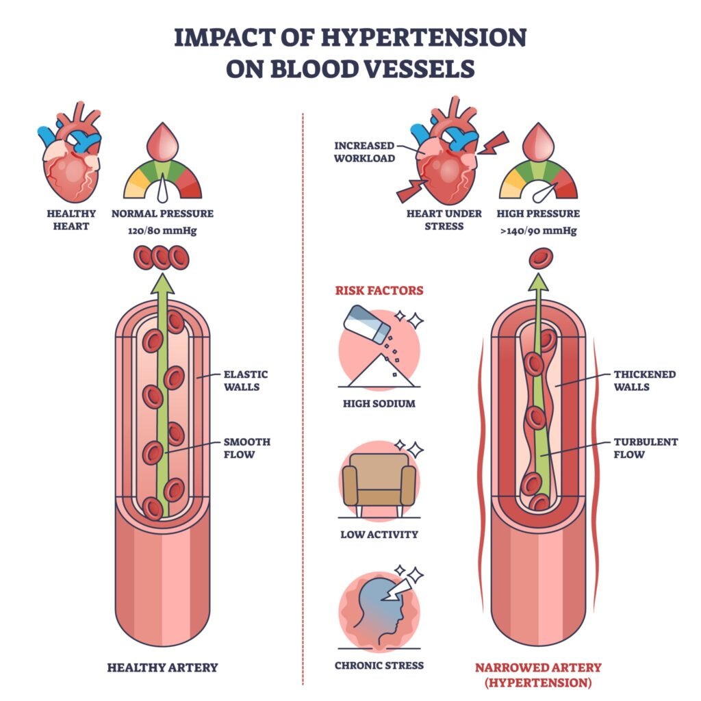 Natural Approaches to Support Healthy Blood Pressure: Evidence-Based Lifestyle Tips and Supplements Amazing 4 17866464848248443156074843133482